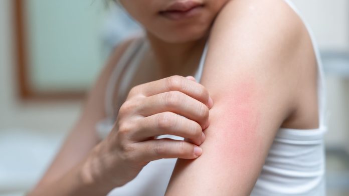 what cancer can cause itchy skin?