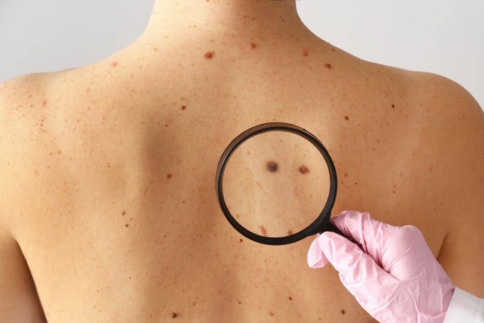 what does skin cancer look like